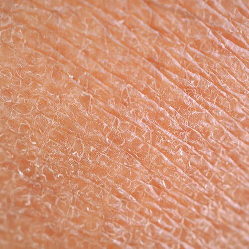 העור שלנו בחורף – מה באמת קורה לו ואיך שומרים עליו נכון?